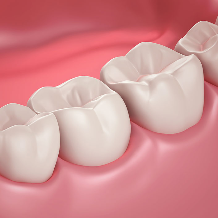 Periodontal Plastic Surgery - Dental Services