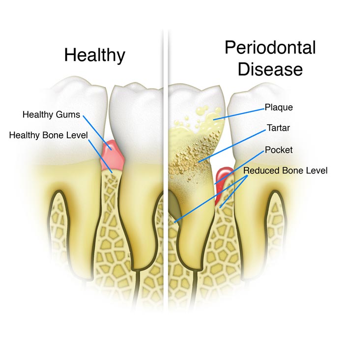Guided Tissue Regeneration

 - Dental Services