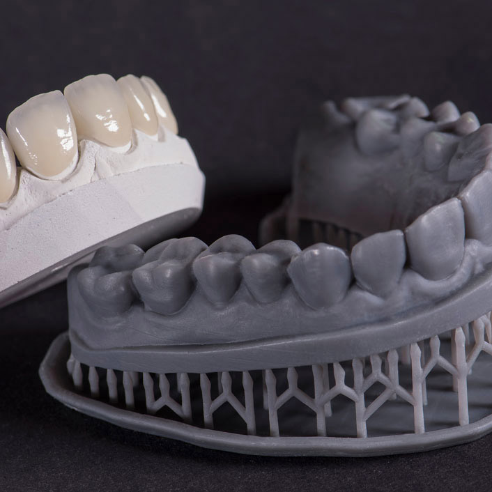 3D Printer - Dental Technology