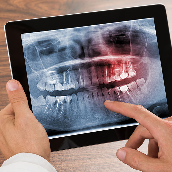 Digital X-Rays - Dental Technology