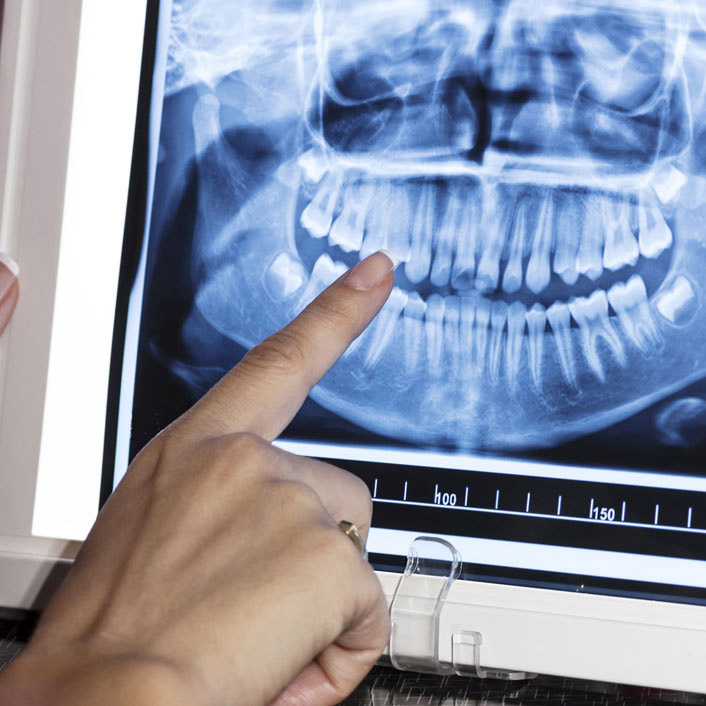 Panoramic X-ray Dental Technology